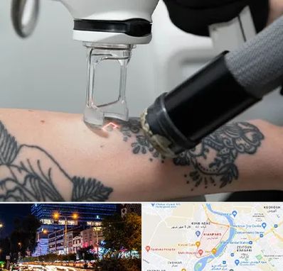 ریمو تاتو در کیانپارس اهواز 