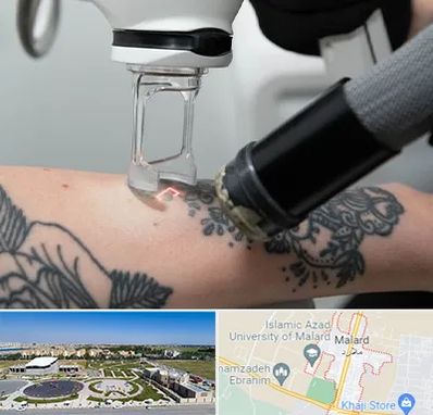 ریمو تاتو در ملارد