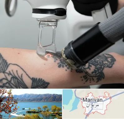 ریمو تاتو در مریوان