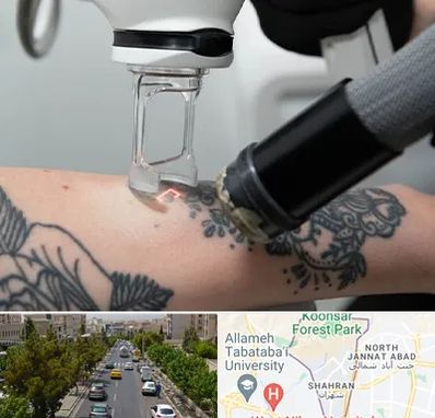 ریمو تاتو در شهران 