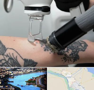 ریمو تاتو در خرمشهر