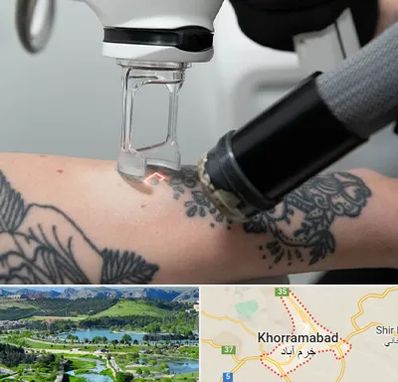 ریمو تاتو در خرم آباد