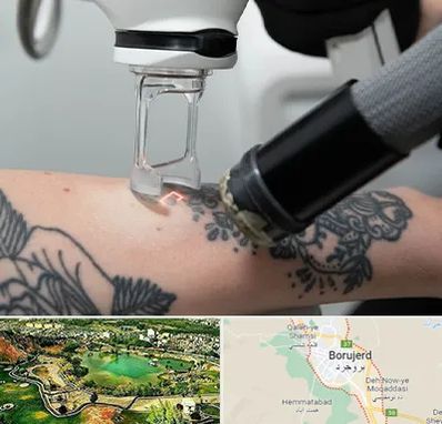 ریمو تاتو در بروجرد