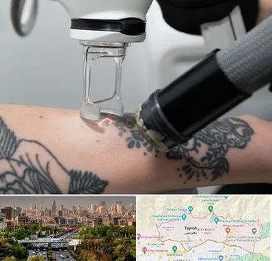 ریمو تاتو در منطقه 1 تهران 