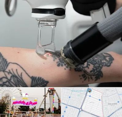 ریمو تاتو در پادادشهر اهواز