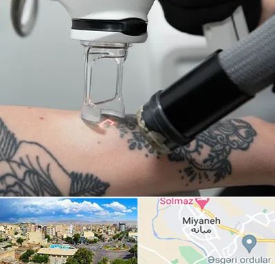 ریمو تاتو در میانه