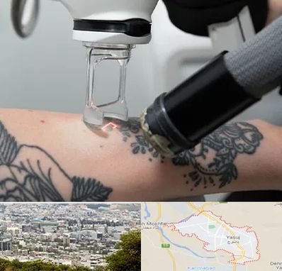 ریمو تاتو در یاسوج