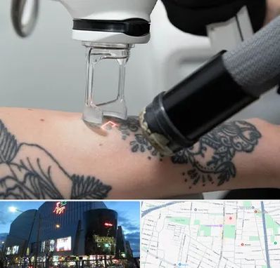 ریمو تاتو در بلوار اباذر