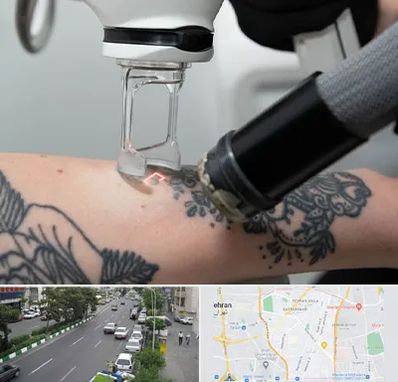 ریمو تاتو در ستارخان 