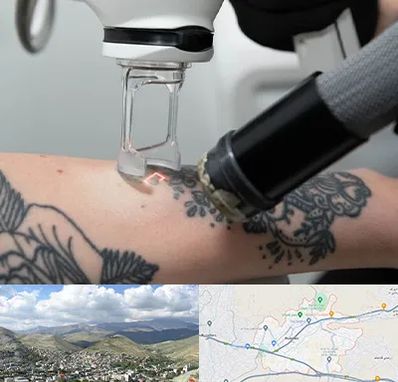 ریمو تاتو در رودهن