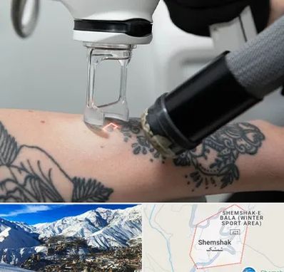 ریمو تاتو در شمشک