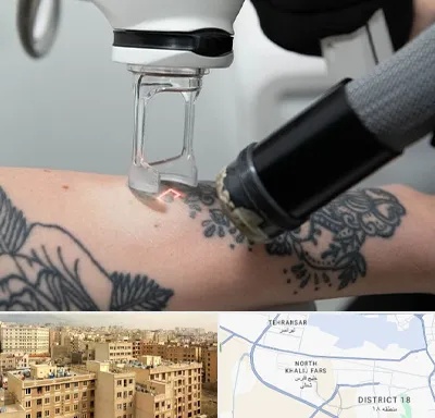 ریمو تاتو در جنوب غرب تهران