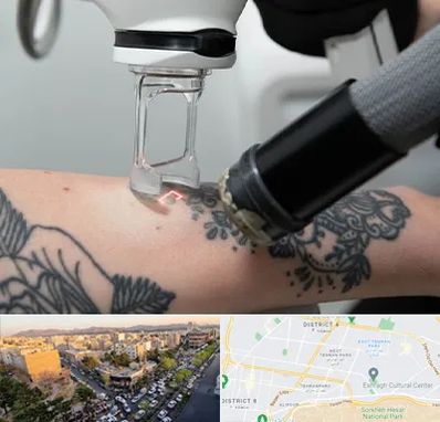 ریمو تاتو در تهرانپارس 