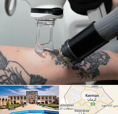 ریمو تاتو در کرمان