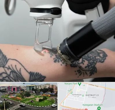 ریمو تاتو در تهرانسر 