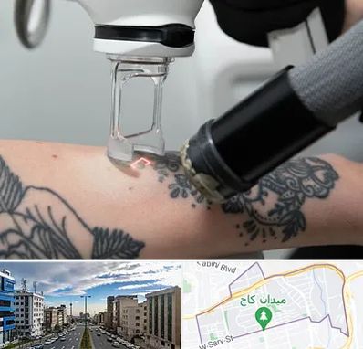 ریمو تاتو در سعادت آباد 