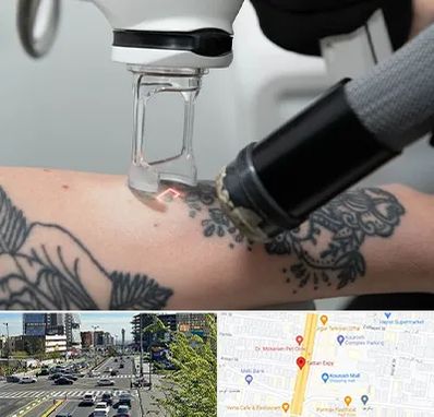 ریمو تاتو در ستاری 