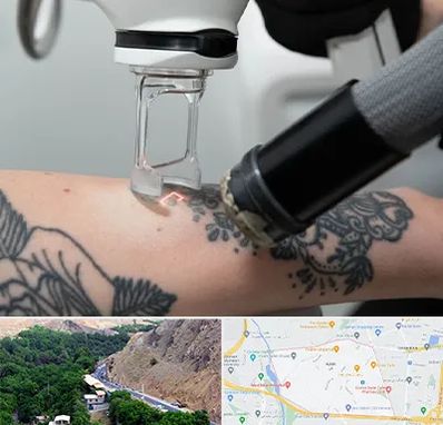 ریمو تاتو در کن 