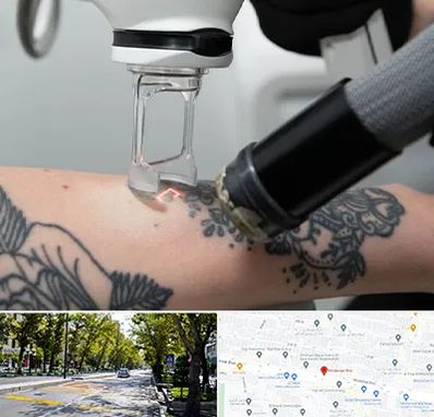 ریمو تاتو در میرداماد 