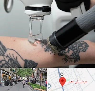 ریمو تاتو در ولیعصر شهریار