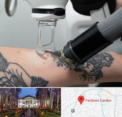 ریمو تاتو در باغ فردوس