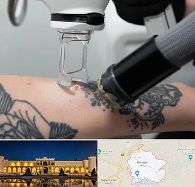 ریمو تاتو در برازجان