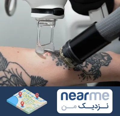 ریمو تاتو در نزدیک من