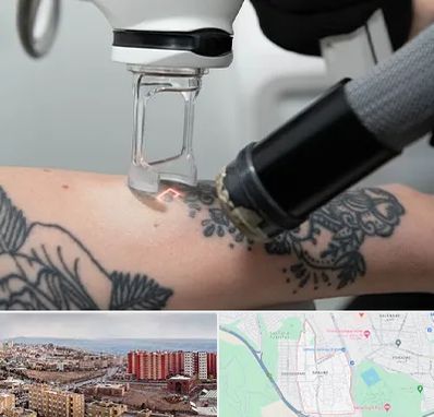 ریمو تاتو در سهند تبریز