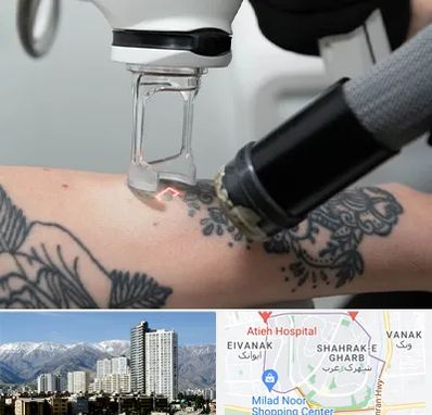 ریمو تاتو در شهرک غرب 