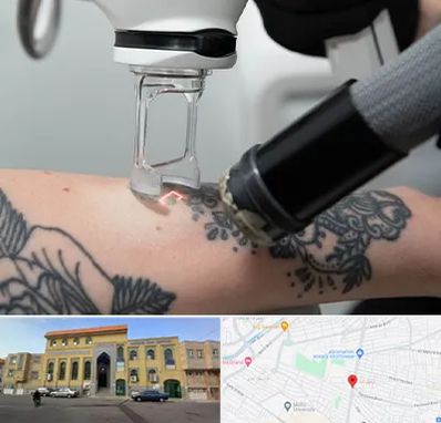 ریمو تاتو در زنبیل آباد قم