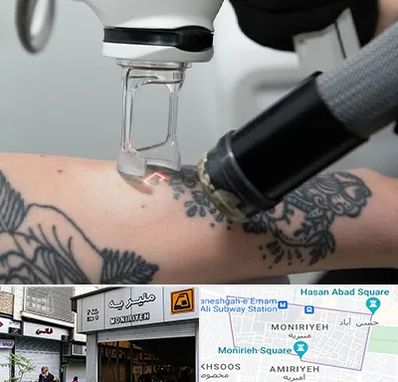 ریمو تاتو در منیریه 