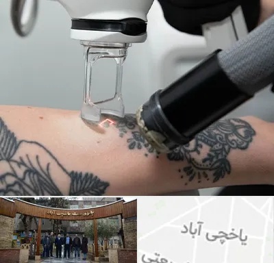 ریمو تاتو در یاخچی آباد