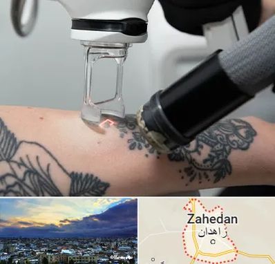 ریمو تاتو در زاهدان