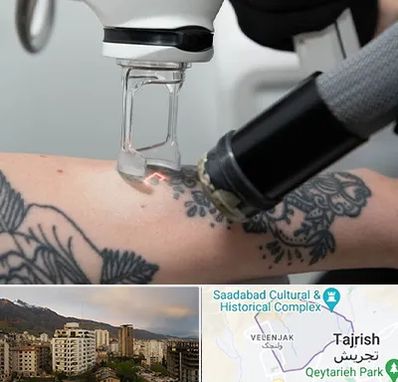 ریمو تاتو در زعفرانیه 