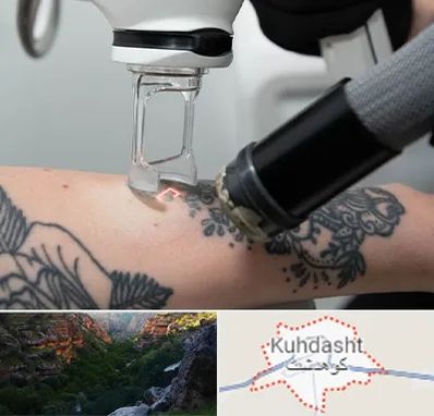 ریمو تاتو در کوهدشت