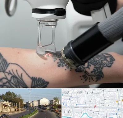 ریمو تاتو در ضیابری رشت 