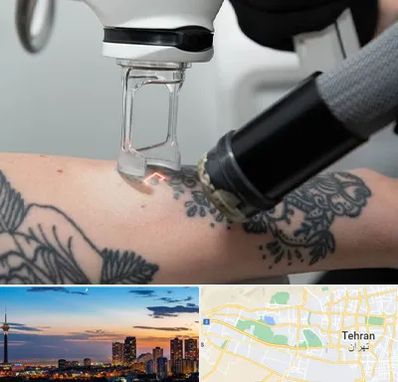 ریمو تاتو در غرب تهران 