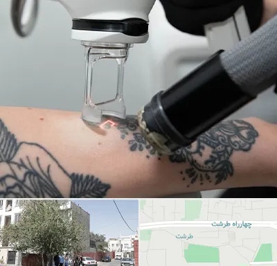 ریمو تاتو در طرشت