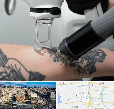 ریمو تاتو در شهرک راه آهن 