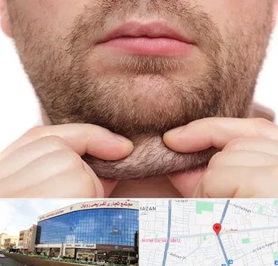 ساکشن غبغب در نصف راه تبریز