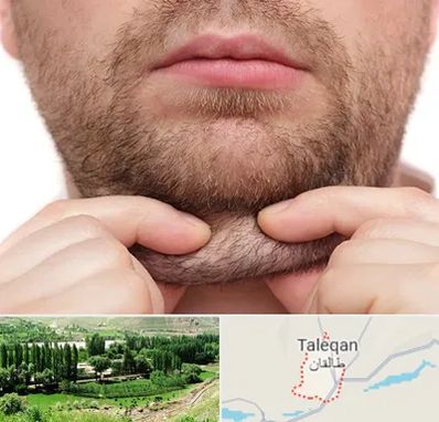 ساکشن غبغب در طالقان