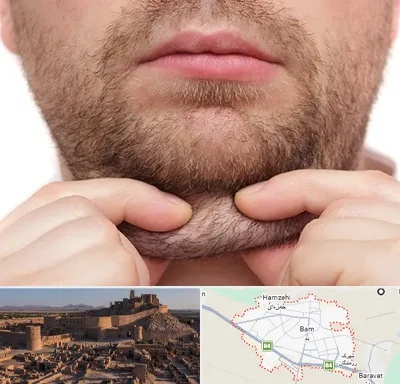 ساکشن غبغب در بم
