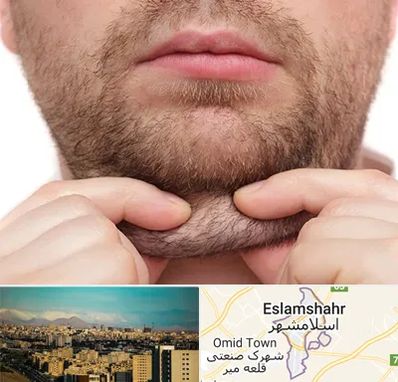 ساکشن غبغب در اسلامشهر