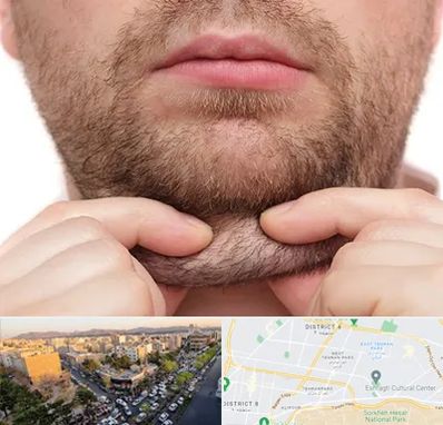 ساکشن غبغب در تهرانپارس 