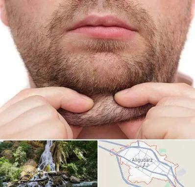 ساکشن غبغب در الیگودرز