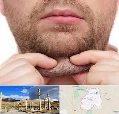 ساکشن غبغب در مرودشت