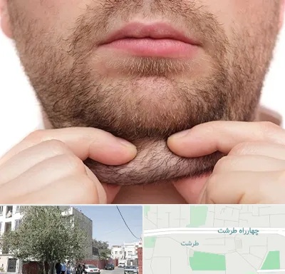 ساکشن غبغب در طرشت