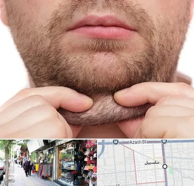 ساکشن غبغب در سلسبیل
