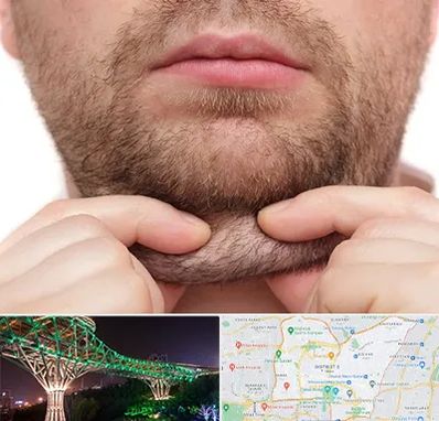 ساکشن غبغب در منطقه 3 تهران 