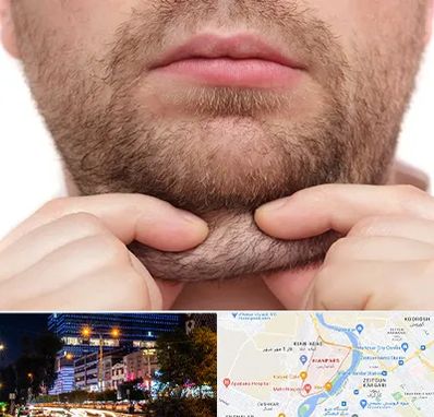 ساکشن غبغب در کیانپارس اهواز 